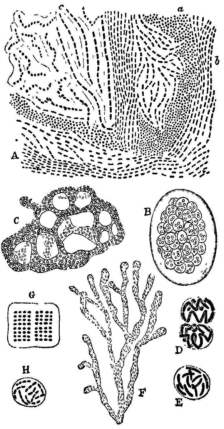 Fig. 3. Types of Zoogloea.