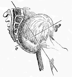 Anterior posterior position